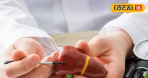 Read more about the article स्किन के रंग में ये बदलाव हैं काली पीलिया के लक्षण, जानें कारण और बचाव के उपाय