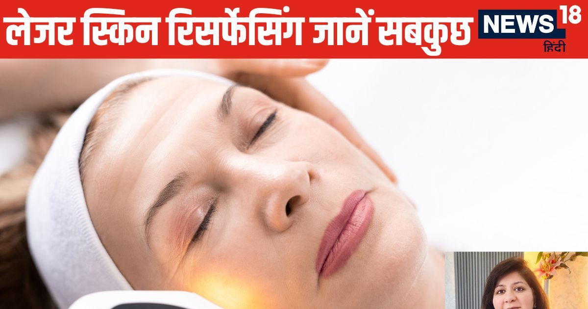 You are currently viewing Skin Treatment: क्या है लेजर स्किन रिसर्फेसिंग? एक्सपर्ट से जानें फायदे-नुकसान, ट्रीटमेंट के बाद की सावधानियां