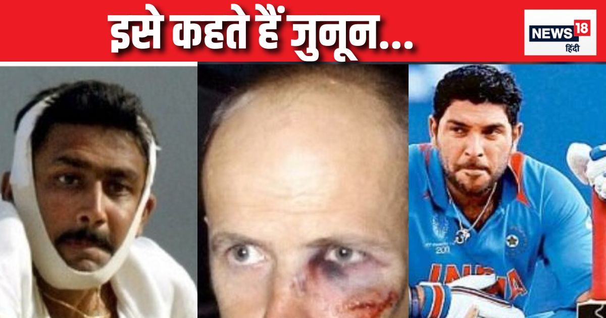 You are currently viewing जब देश के लिए क्रिकेटर्स ने लगाई जान की बाजी, कोई टूटे जबड़े, तो कोई…