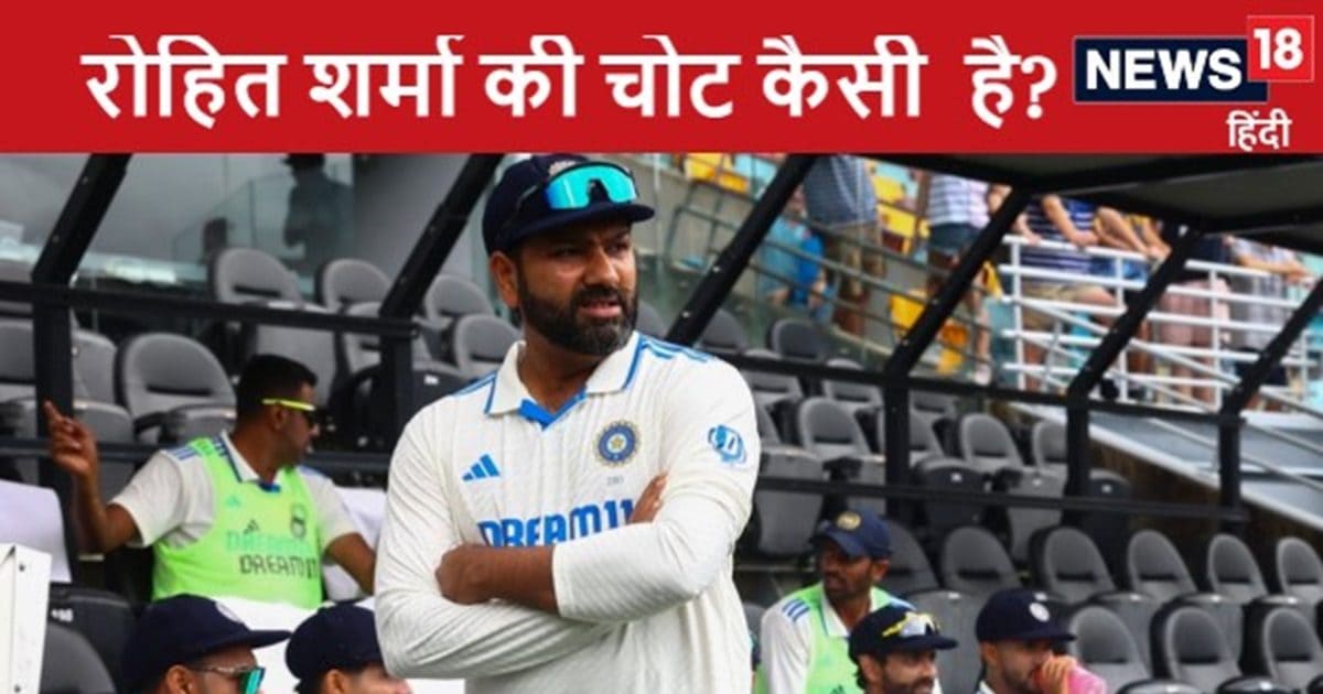 You are currently viewing Rohit Sharma injury: कप्तान रोहित शर्मा पर आकाश दीप का गजब बयान, खेलेंगे तो चोट भी लगेगी कोई बड़ी बात नहीं…