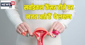 Read more about the article सर्वाइकल कैंसर के शुरुआती लक्षण और निदान: जानें विशेषज्ञ की राय