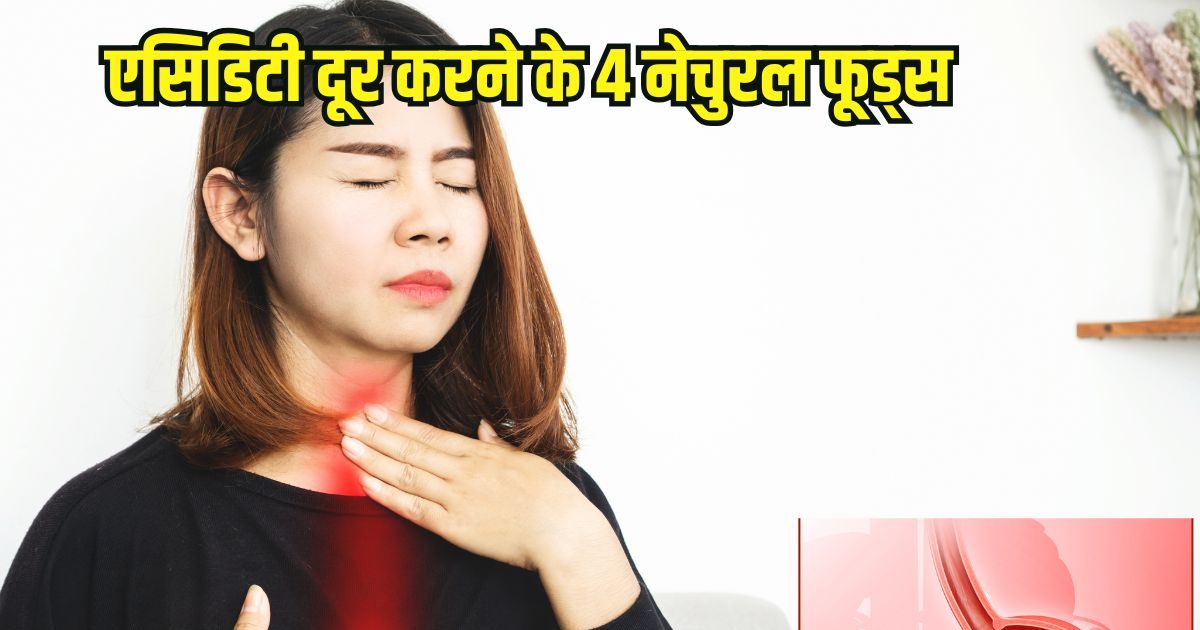 You are currently viewing Natural remedies for acidity: गर्मी में एसिडिटी की समस्या सताए, दूर करने के लिए खाएं 4 नेचुरल फूड्स