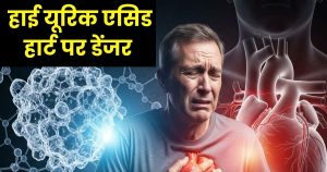 Read more about the article Doctor Explain How to reduce Uric acid increase heart Attack | यूरिक एसिड बढ़ने से हार्ट अटैक का खतरा बढ़ेगा