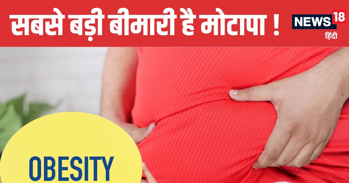 You are currently viewing Obesity Can Cause over 200 diseases Know Health Risks and Prevention | मोटापे के कारण बढ़ता है 200 बीमारियों का खतरा