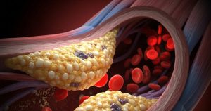Read more about the article What To Avoid In High Cholesterol: बढ़ा हुआ है कोलेस्ट्रॉल, तो न खाएं ये 3 फूड्स